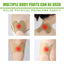 EELHOE Mugwort Heating Patch for Comfort and Relief