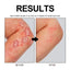 Cowhide Moss Repair Spray Relieves Redness And Itchy Scalp Skin Repair Spray - Korvel