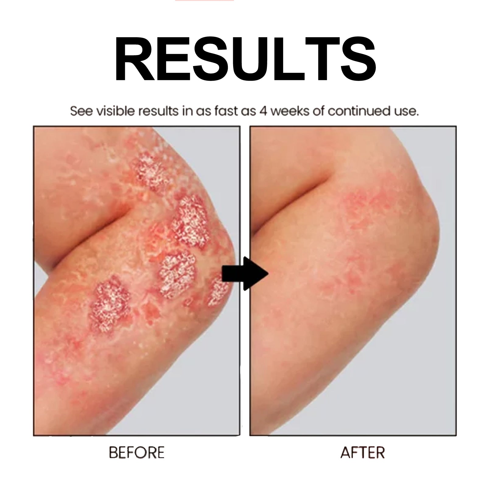 Cowhide Moss Repair Spray Relieves Redness And Itchy Scalp Skin Repair Spray - Korvel
