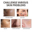 Dark Spot Serum, Fade Spot Moisturize Skin Repair Blain Mark Face Dull Shine Essence - Korvel