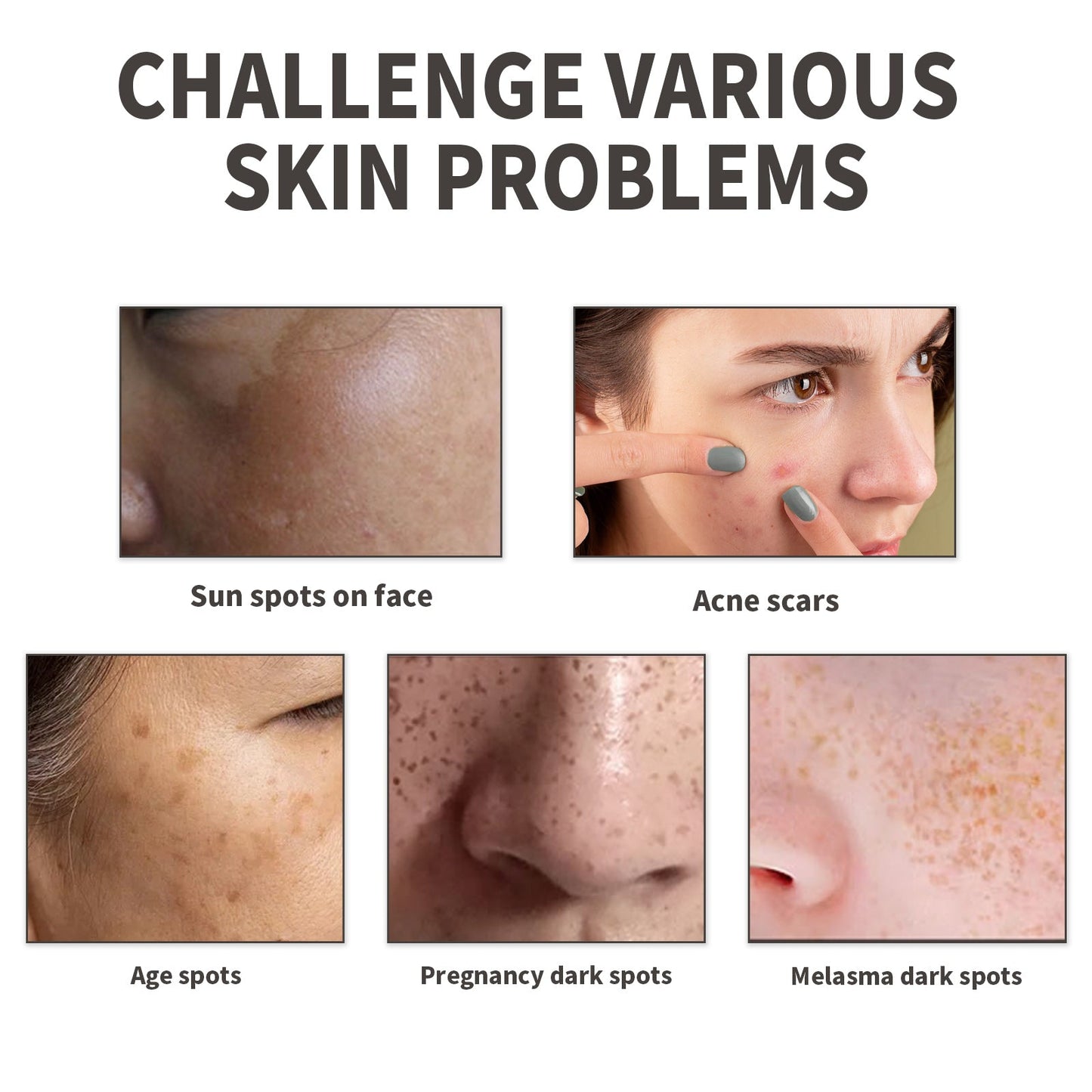 Dark Spot Serum, Fade Spot Moisturize Skin Repair Blain Mark Face Dull Shine Essence - Korvel