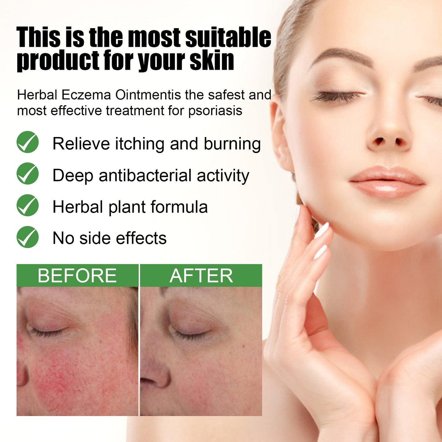 Onguent Herbal de Soulagement de l'Eczéma pour les Mains et les Pieds