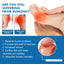 Thumb Toe Correction Patch, Big Toe Valgus Toe Swelling Correction Joint Pain Care Patch - Korvel