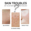 Blackhead Cleansing Cream Skin Oil Blackheads Acne Exfoliating Cleansing Repair Pore Tearing Nose Patch - Korvel