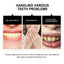 Teeth Whitening Powder, Teeth whitening beauty teeth cleaning tartar teeth yellow smoke teeth care for the mouth - Korvel