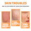 Loose Powder, Fade Fine Lines, Waterproof, Sweat Resistant Makeup Natural Concealer Complete Makeup Powder Light And Delicate - Korvel