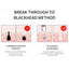 Blackhead Remover Face Deep Pore Cleaner Removal Vacuum Suction Facial SPA Diamond Beauty Care Tool Skin Care - Korvel
