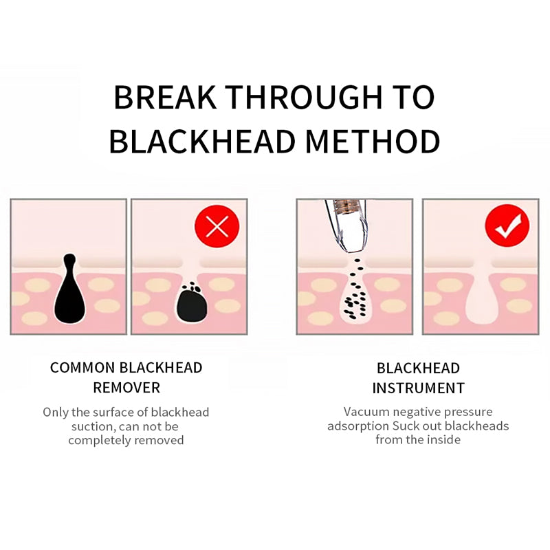 Blackhead Remover Face Deep Pore Cleaner Removal Vacuum Suction Facial SPA Diamond Beauty Care Tool Skin Care - Korvel