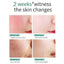 SKIN EVER Centella Repair Face Cream Moisturizing and Moisturizing Repair Facial Skin Face Cream Skin Care Product SK017 - Korvel