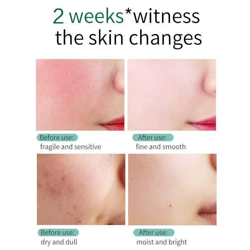 SKIN EVER Centella Repair Face Cream Moisturizing and Moisturizing Repair Facial Skin Face Cream Skin Care Product SK017 - Korvel