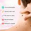 Verruca Rose Essential Oil Soap Body Cleaning Nevus Verruca Face And Neck Silk Verruca Essence Soap - Korvel