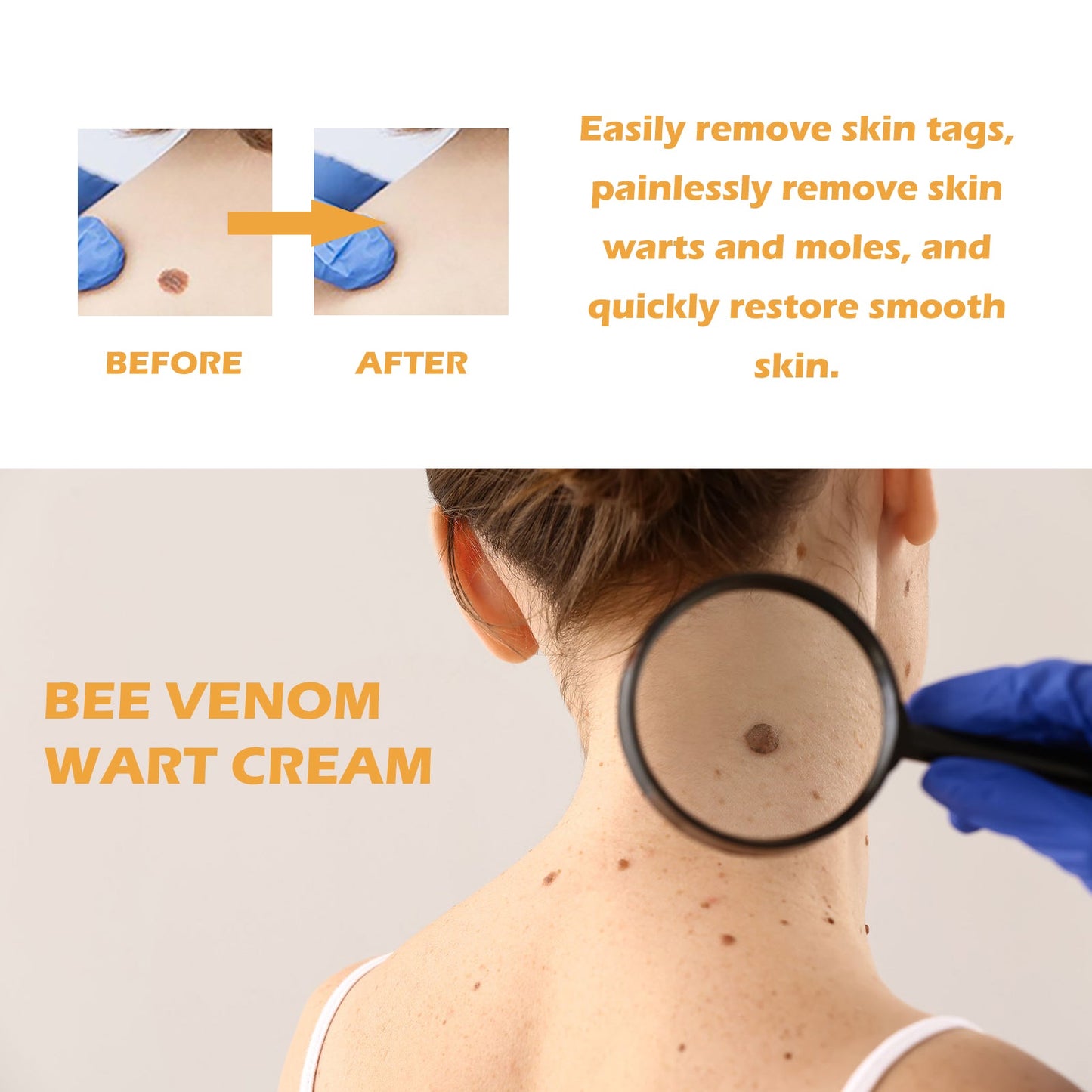 Premium Bee Venom Wart Care Cream for Smooth Skin