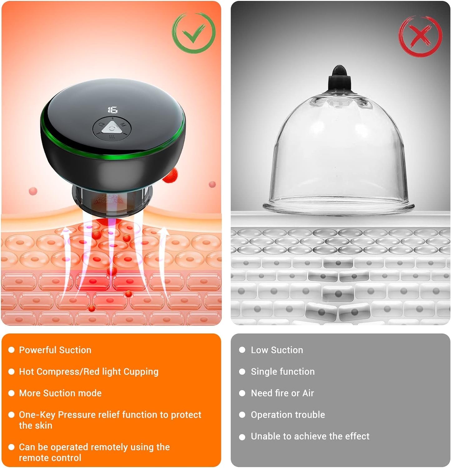 Electric Smart Cupping Therapy Set - 5 in 1 Remote Control