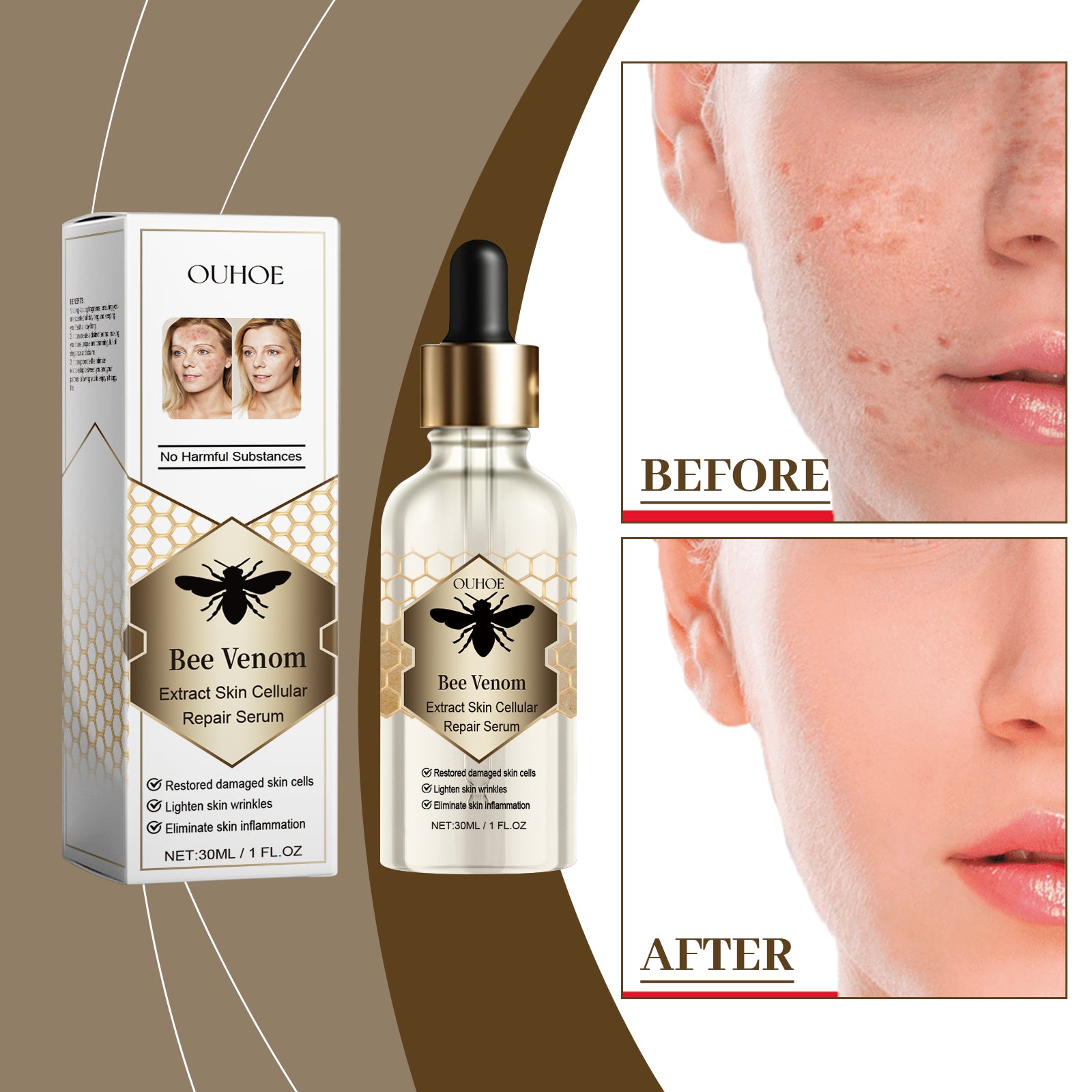 Bee Venom Skin Repair Essence, Body Skin Smoothing And Firming Gentle Moisturizing Massage Treatment Essence - Korvel