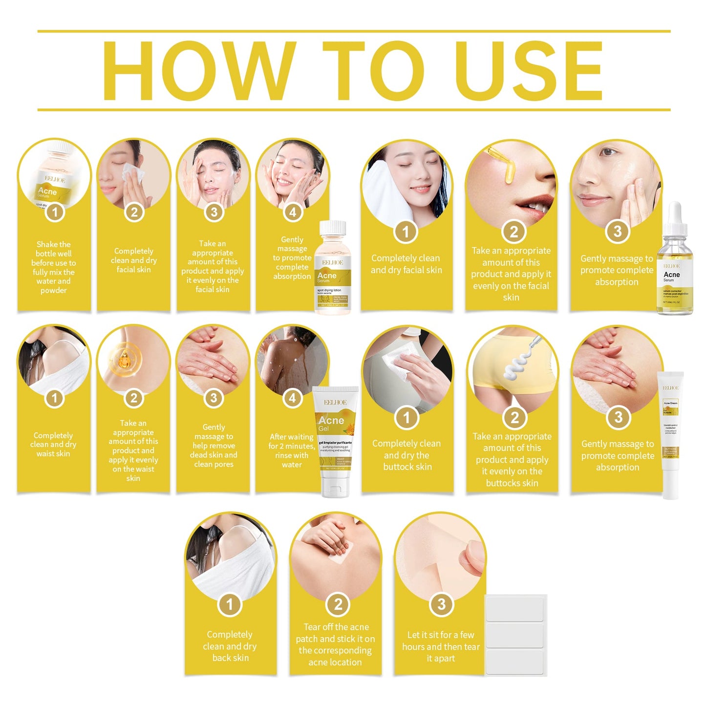 Acne Skin Care Set Skin Care For Acne Skin Is Suitable For Moisturizing And Beautify Soft Skin - Korvel