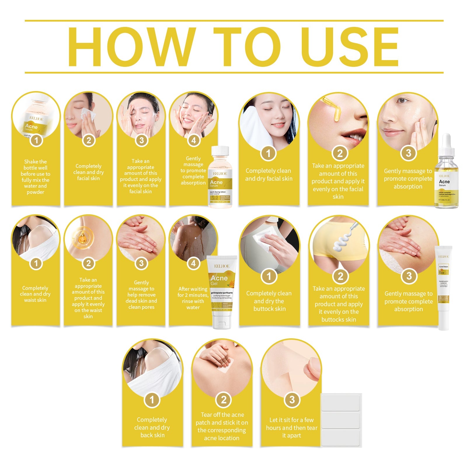 Acne Skin Care Set Skin Care For Acne Skin Is Suitable For Moisturizing And Beautify Soft Skin - Korvel