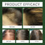 Rosemary Oil For Hair Growth, Promotes Healthy And Nourishing Strong Hair Essential Oil Hair Growth Oil - Korvel