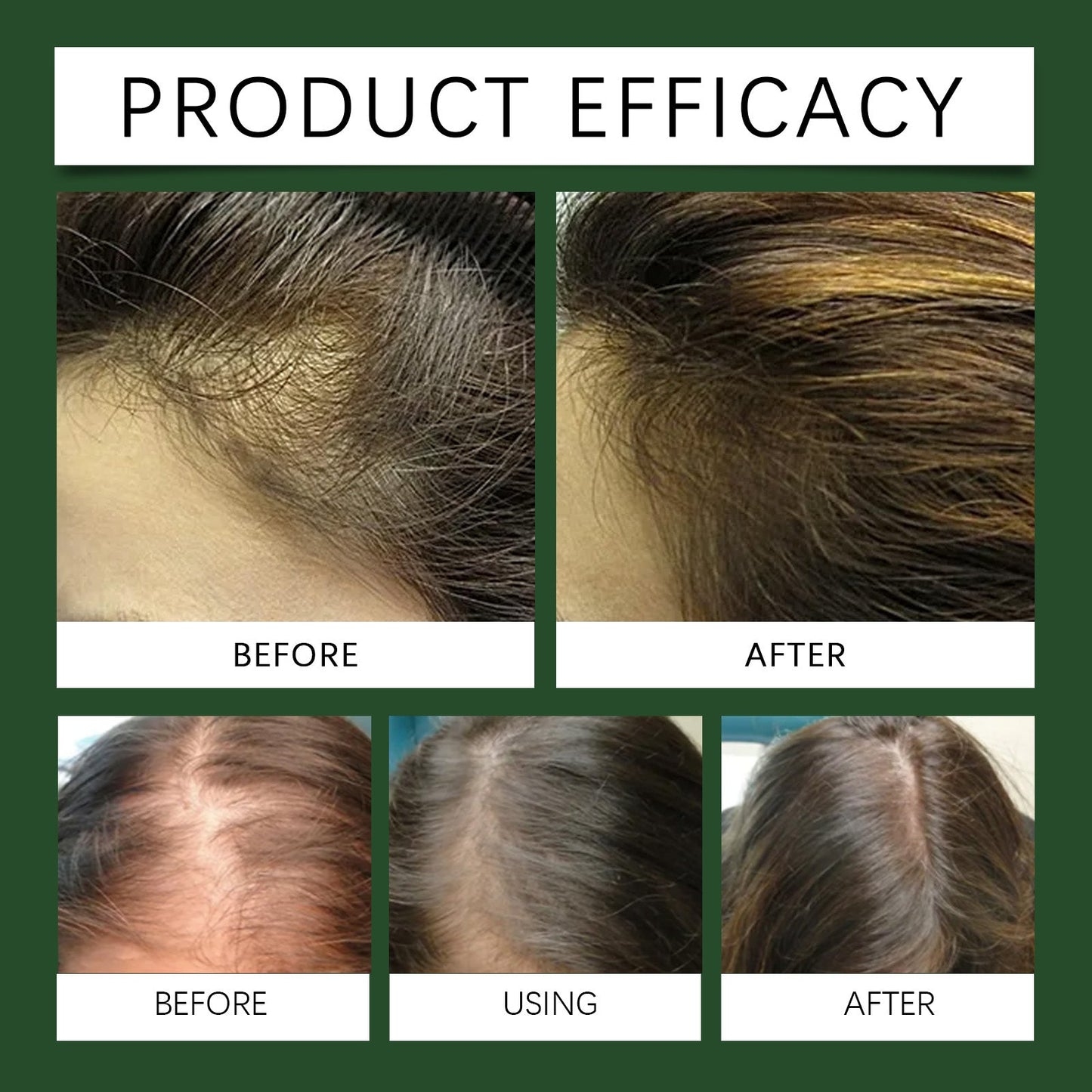 Rosemary Oil For Hair Growth, Promotes Healthy And Nourishing Strong Hair Essential Oil Hair Growth Oil - Korvel