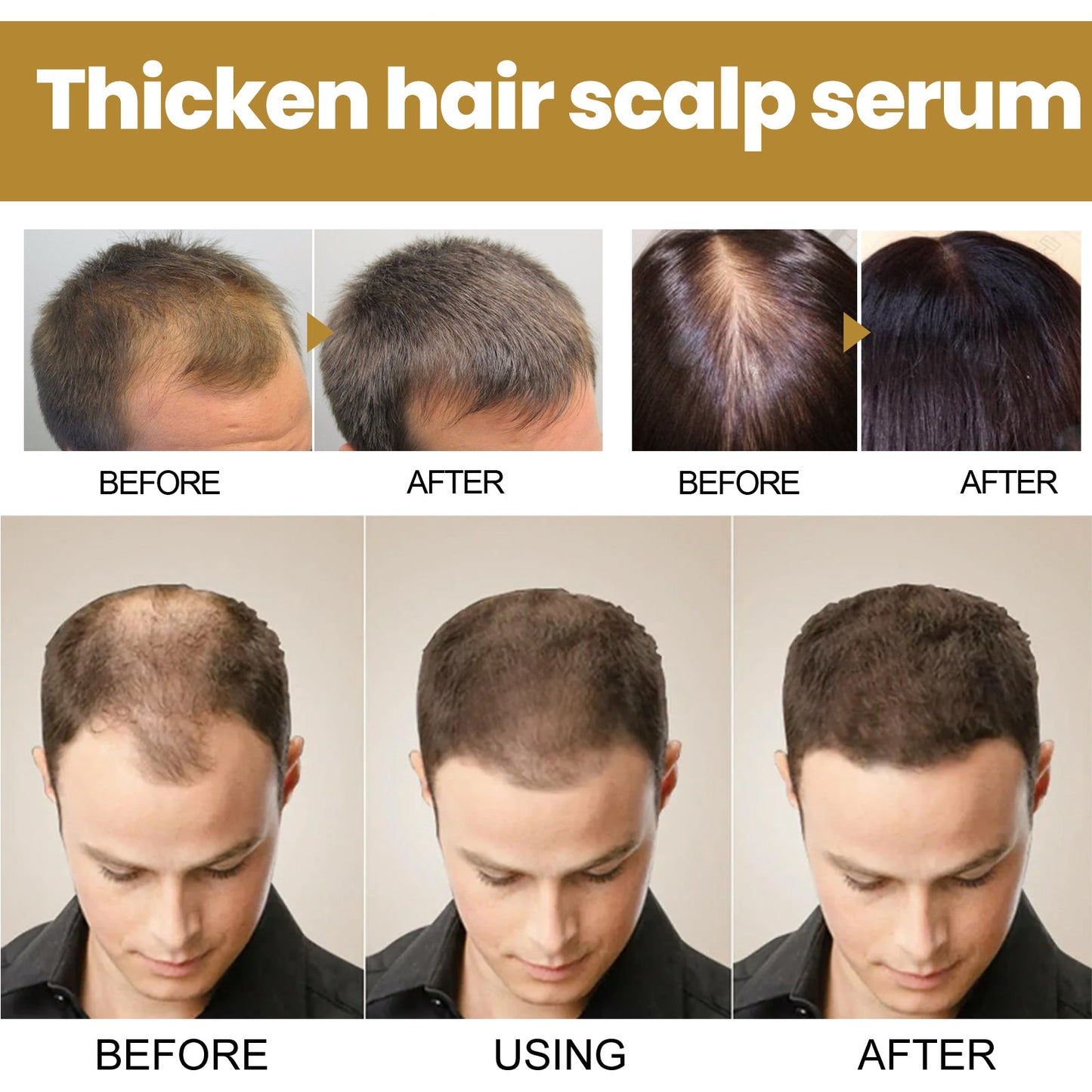 Tight Hair Shampoo Hair Cleansing Massage Scalp To Prevent Loose Tight Hair Roots Strong And Solid Hair Shampoo - Korvel