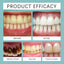 Premium Instant Tooth Whitening Paint for Bright Smiles