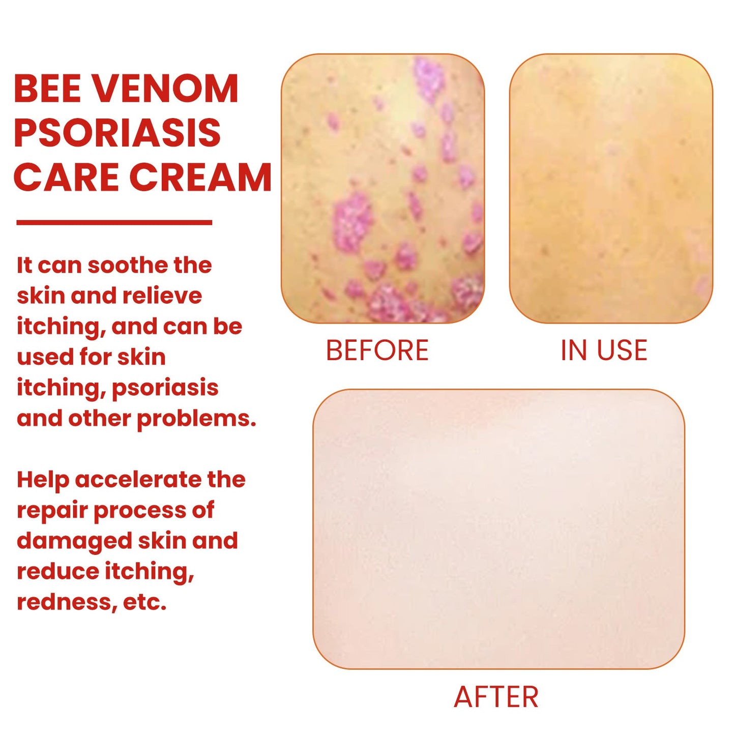 Crema de Musgo de Piel de Vaca con Veneno de Abeja Premium para la Comodidad de la Piel