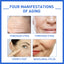 Collagen Face Essence Gently Nourishes Skin Hydrating And Moisturizing Face Care Essence - Korvel