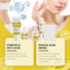 Acne Skin Care Set Skin Care For Acne Skin Is Suitable For Moisturizing And Beautify Soft Skin - Korvel
