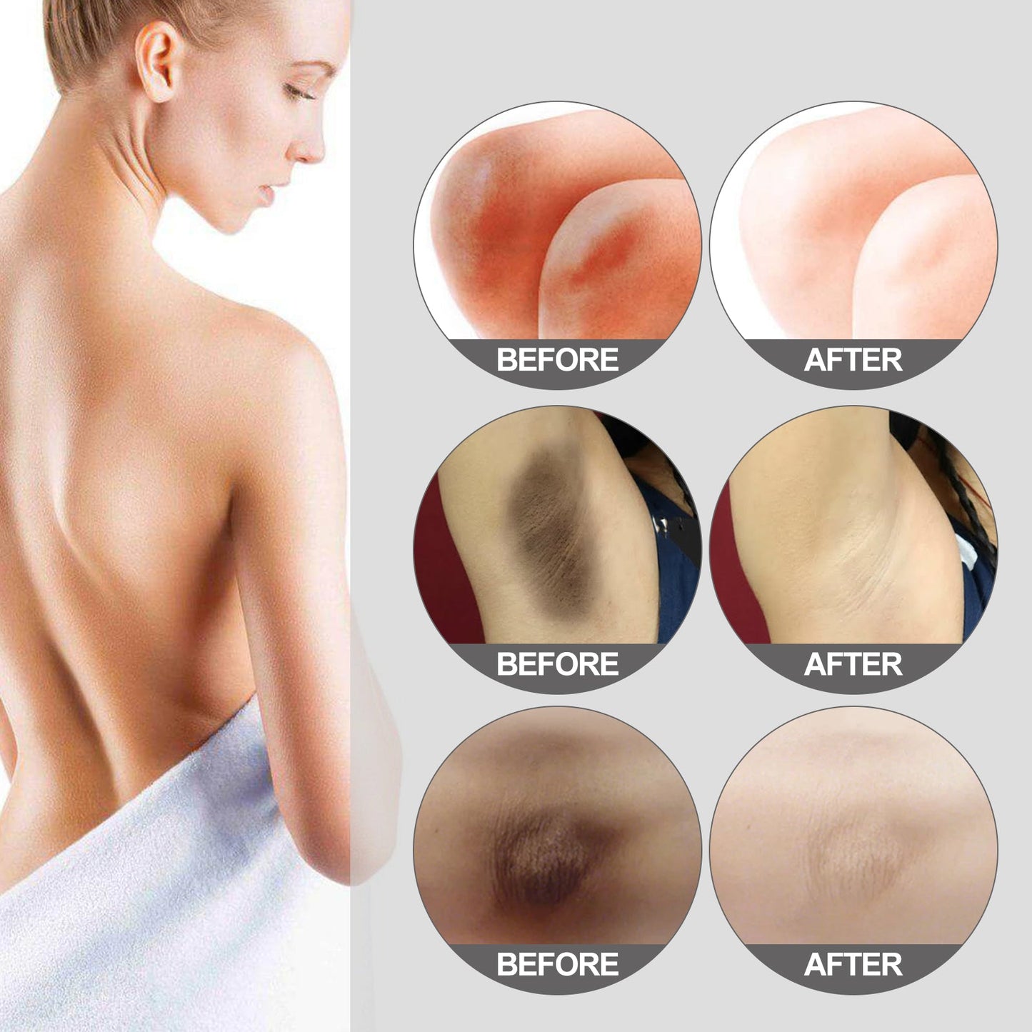 Thigh Radiance Moisturizing And Brightening Cream For Armpit Thighs And Knees - Korvel