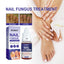Nail Repair Lotion, Repair Thickening Nail Inlay Gray Nail Shine Soft Nail Care Solution - Korvel