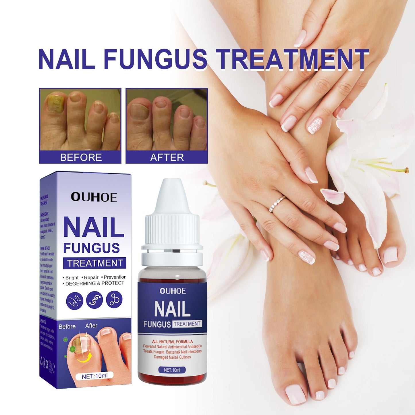 Nail Repair Lotion, Repair Thickening Nail Inlay Gray Nail Shine Soft Nail Care Solution - Korvel