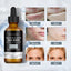 Salicylic Acid Facial Essence, Lighten Acne Mark Repair Hydrating Facial Care Essence - Korvel