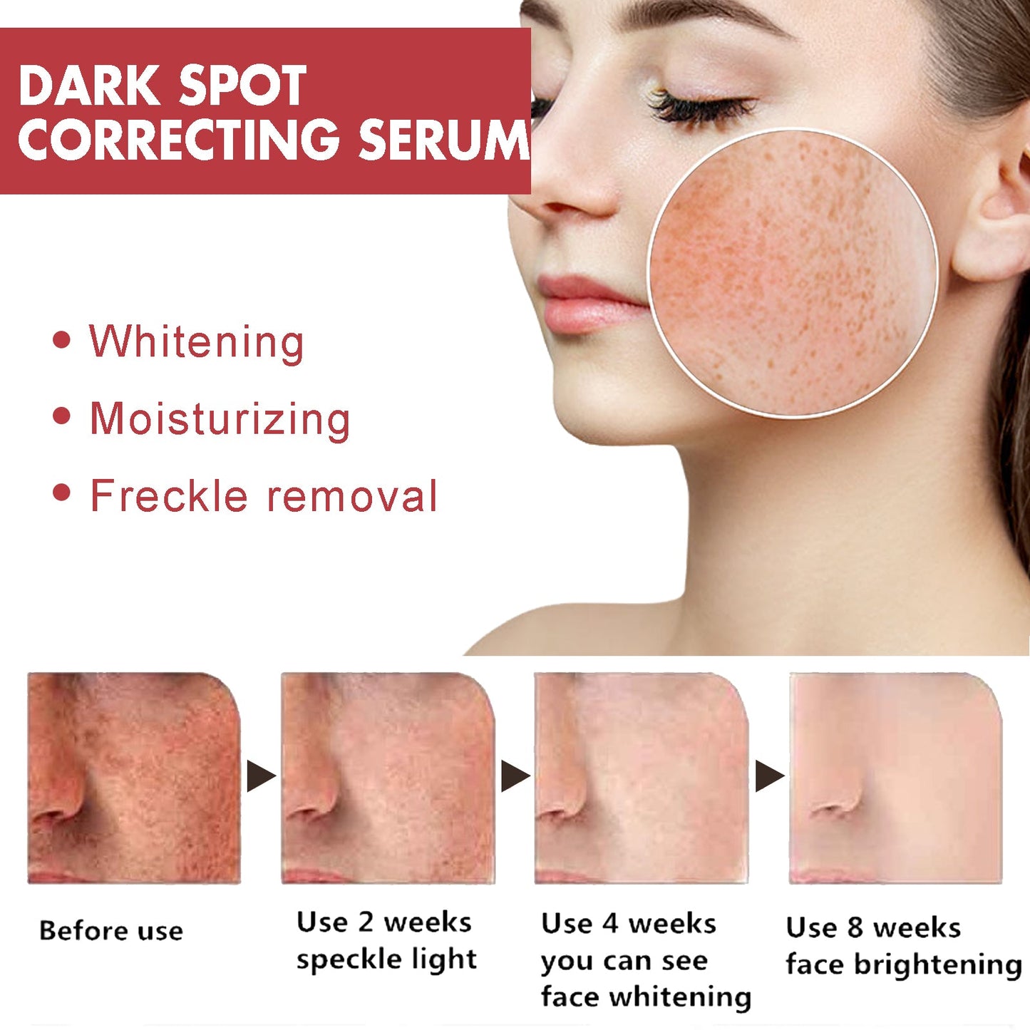Dark Spots Repair Essence, Moisturizing And Brightening Repair Essence For Dark Spots And Age Spots - Korvel