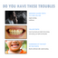 Premium Teeth Whitening Pen for Bright Smiles