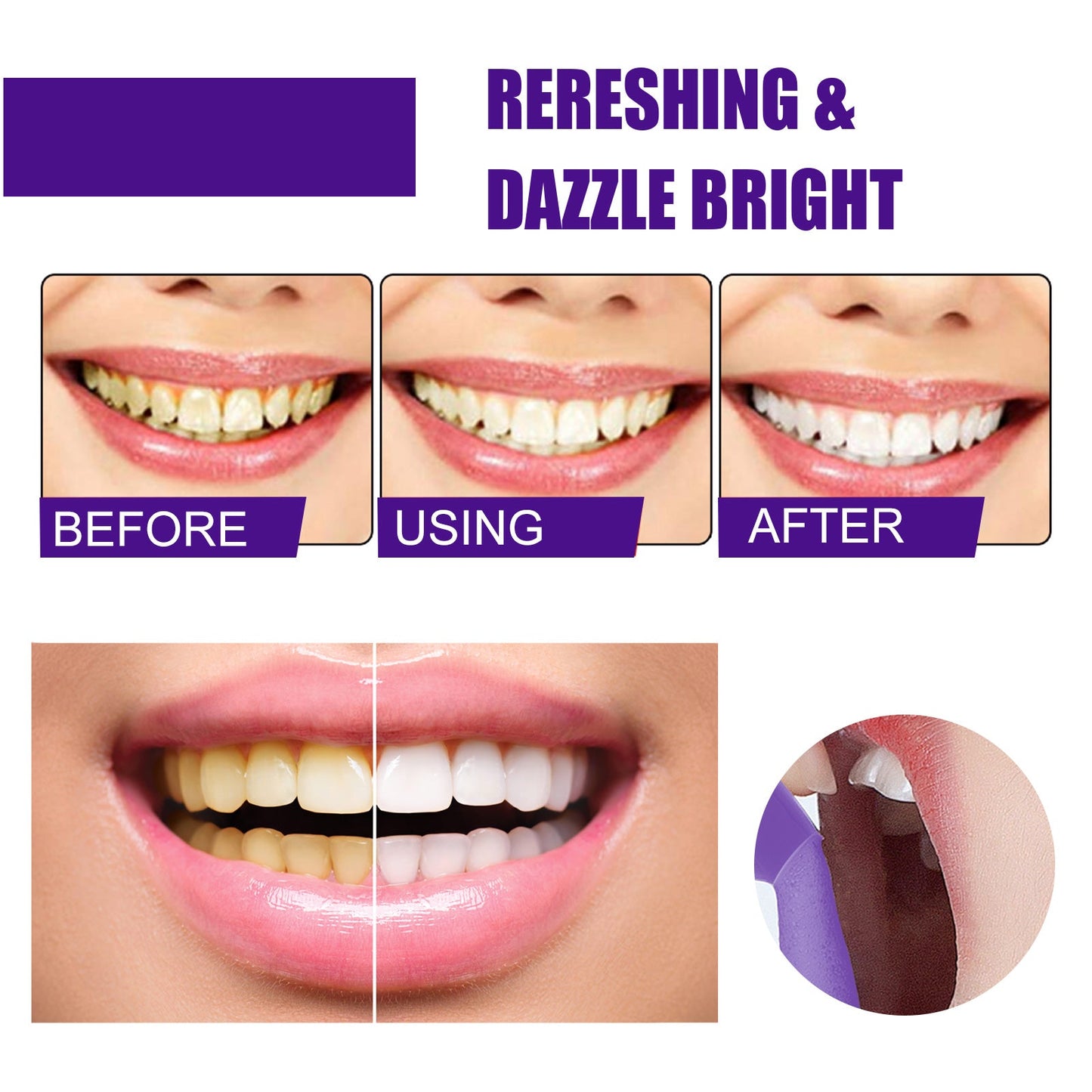 Mousse Dentaire V34 Teinte Violette pour Élimination des Taches