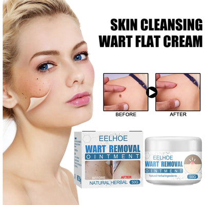 Premium Wart Cream for Smooth Skin Care