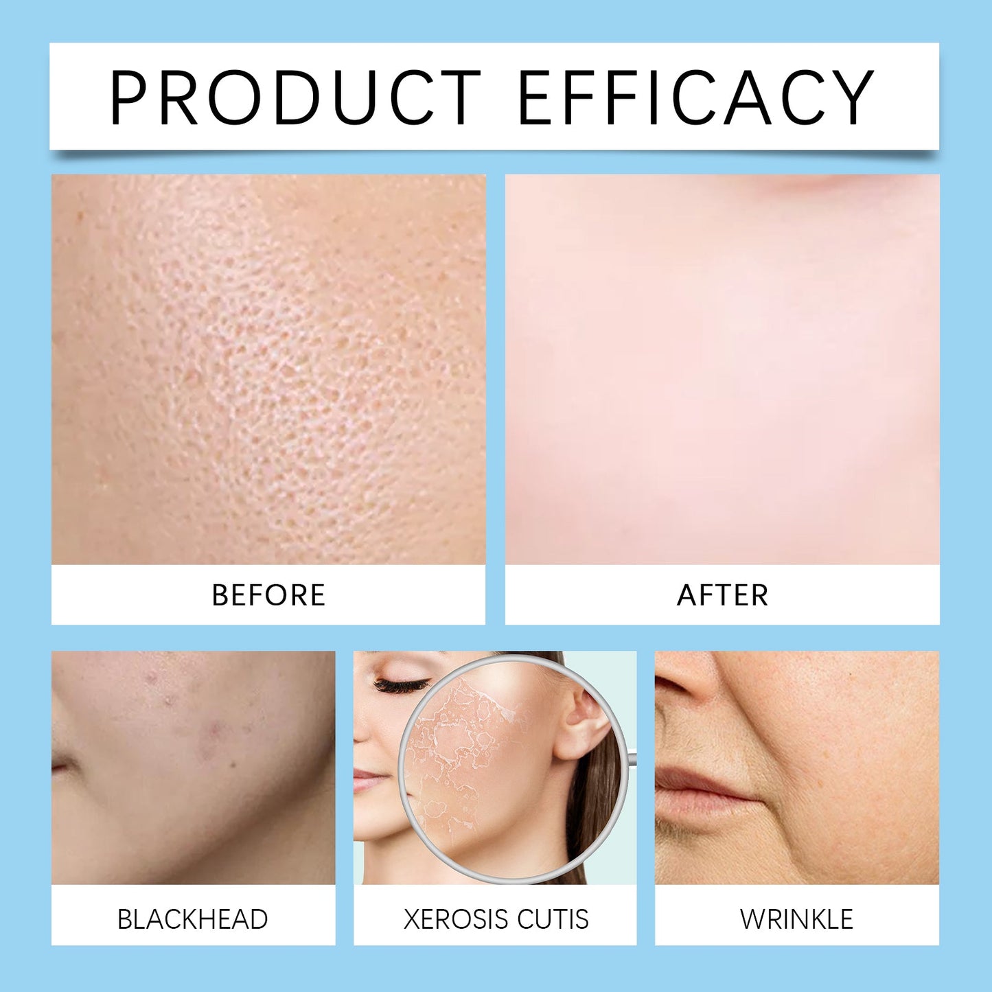 Hyaluronic Acid Stock Solutions, Improve The Skin Pores Hydrating Facial Luster - Korvel