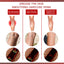 Aricose Veins Medical Cream, Relieve Leg Swelling Earthworm Leg Vein Massage To Relieve Pain - Korvel