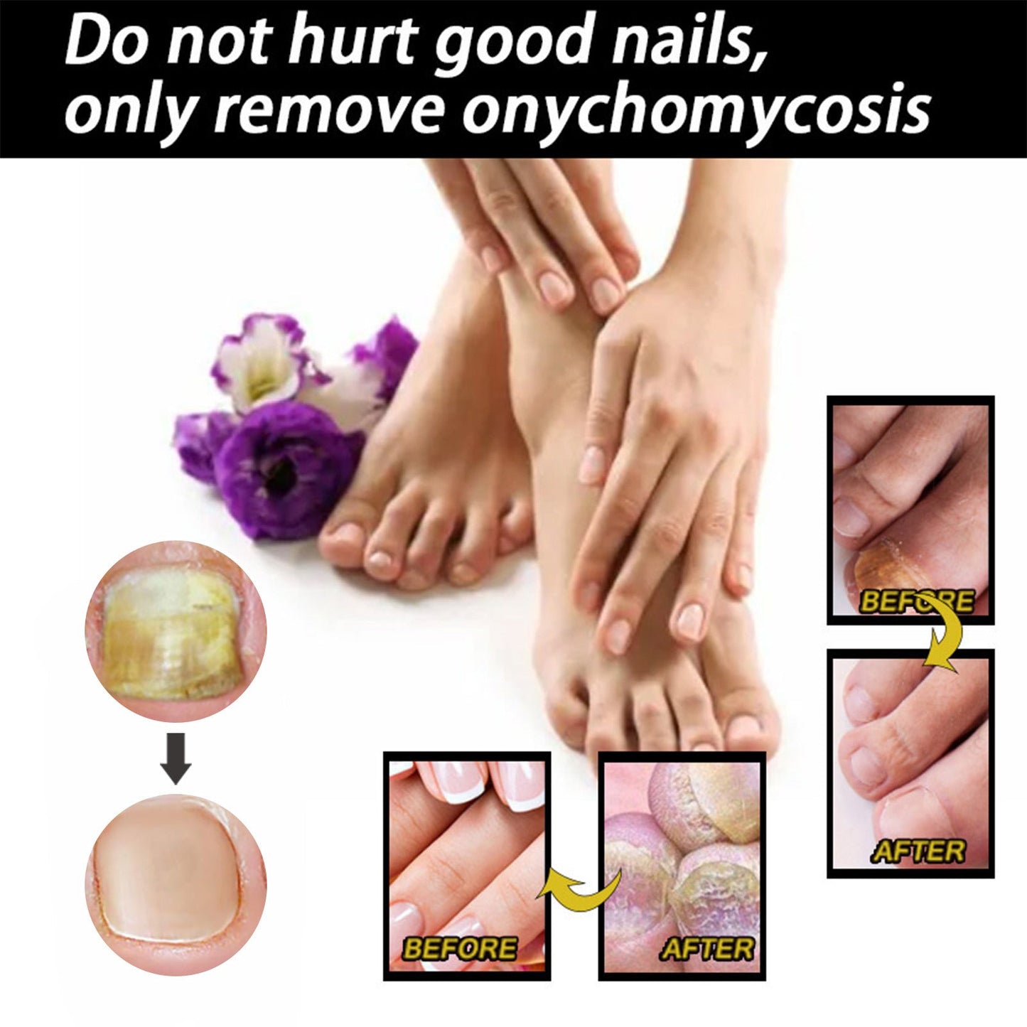 Solution de soin des ongles nourrissante pour des ongles sains et beaux