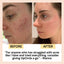 Face Toner with Hyaluronic Acid - Korvel