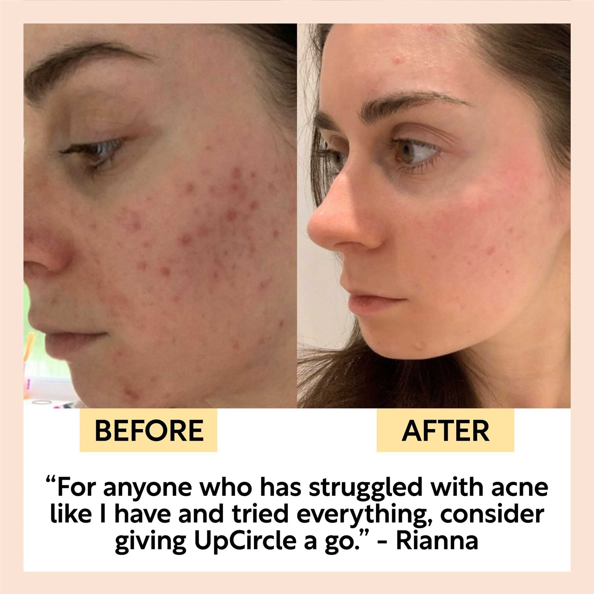 Face Toner with Hyaluronic Acid - Korvel
