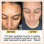 Face Toner with Hyaluronic Acid - Korvel
