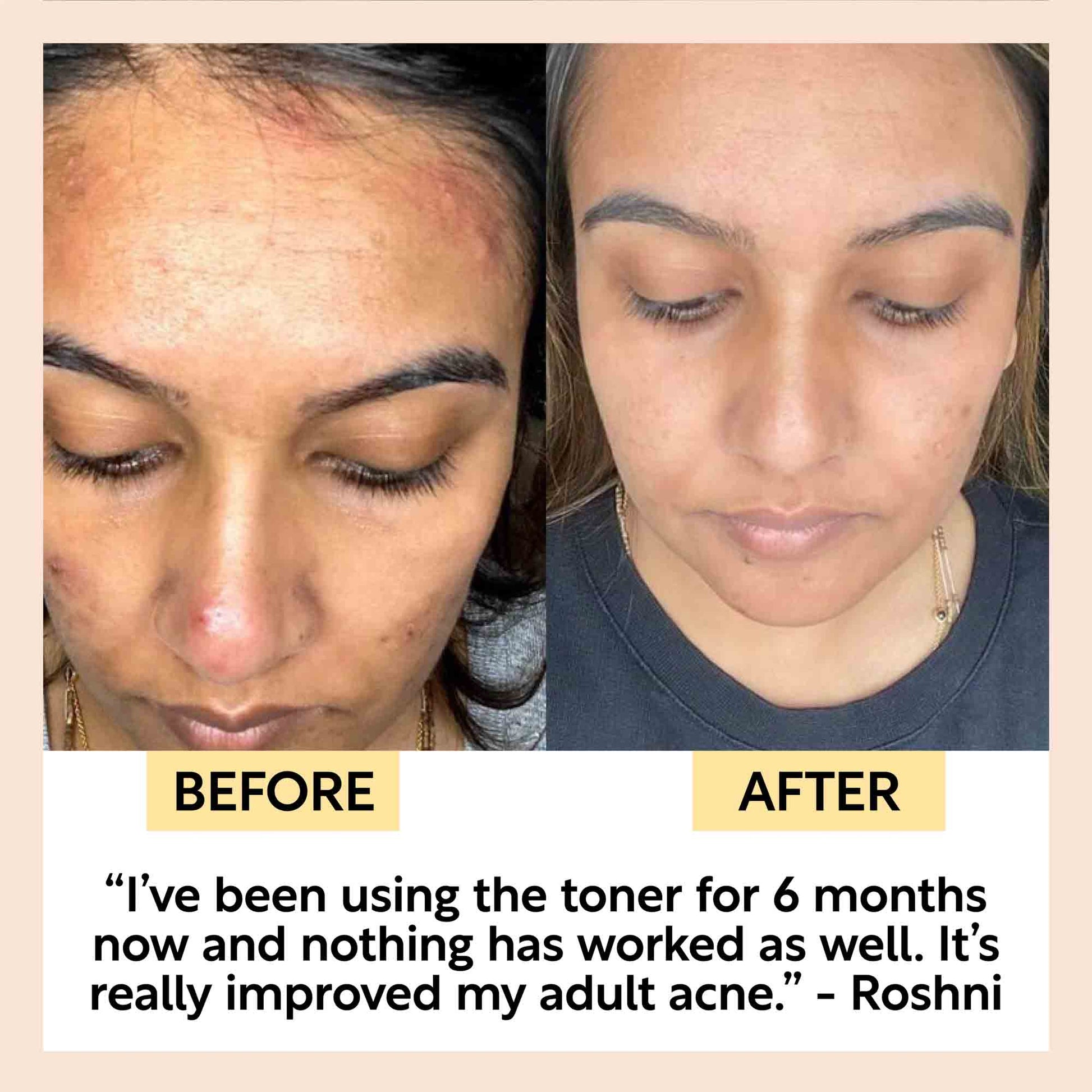 Face Toner with Hyaluronic Acid - Korvel