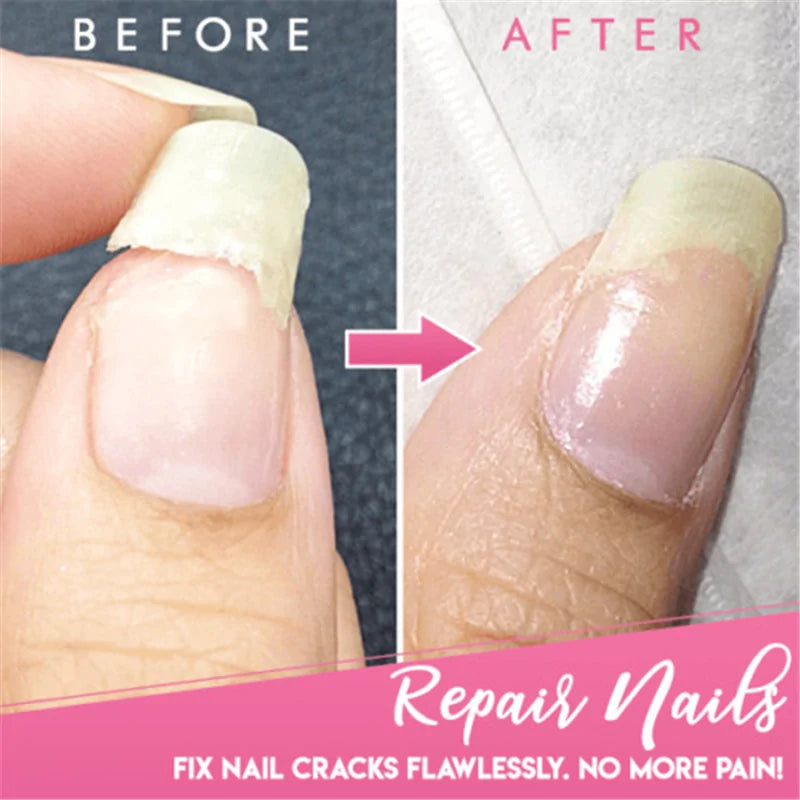 Cracked Nail Repair Gel - Strengthen and Restore