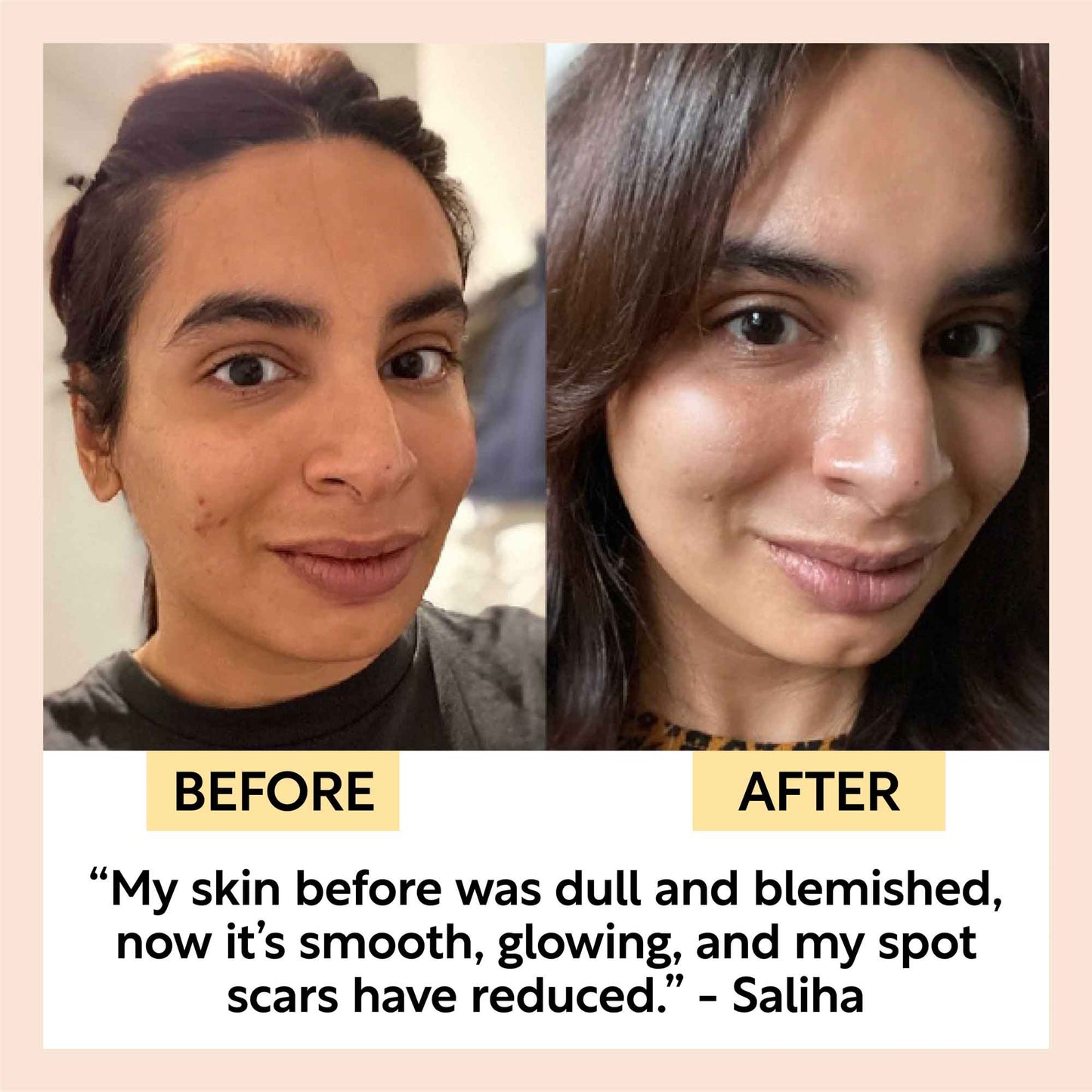 Gua Sha Facial Massage Stone - Korvel
