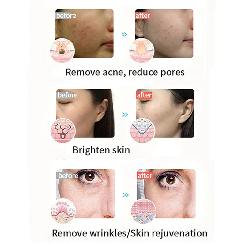 LED Face Light Therapy Photon Facial Mask 3 Color Anti Aging Wrinkle Skin Rejuvenation Skin Care Tool Home Beauty Instrument Spa - Korvel