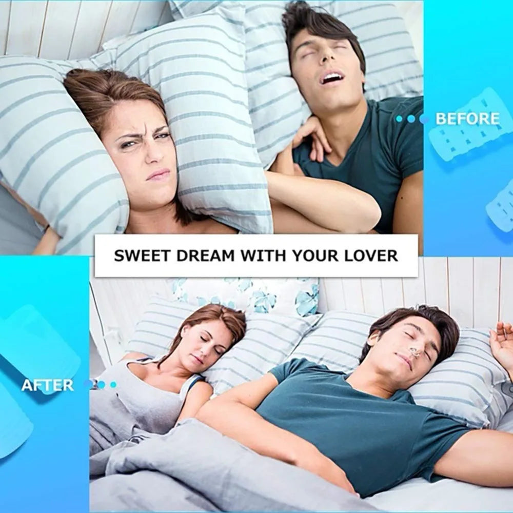 8PCS Snoring Solution Nose Vents for Better Sleep