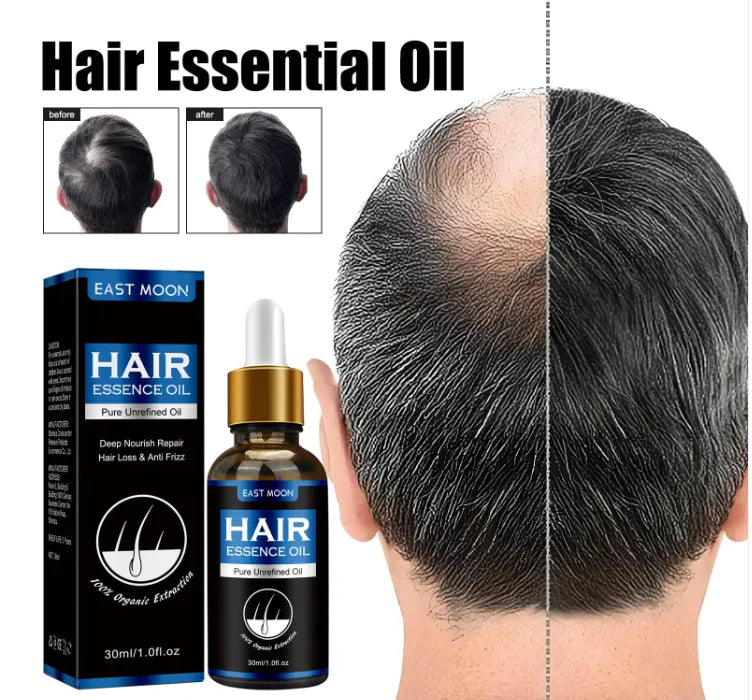 Esencia para el Crecimiento del Cabello Masculino - Revitaliza y Nutre