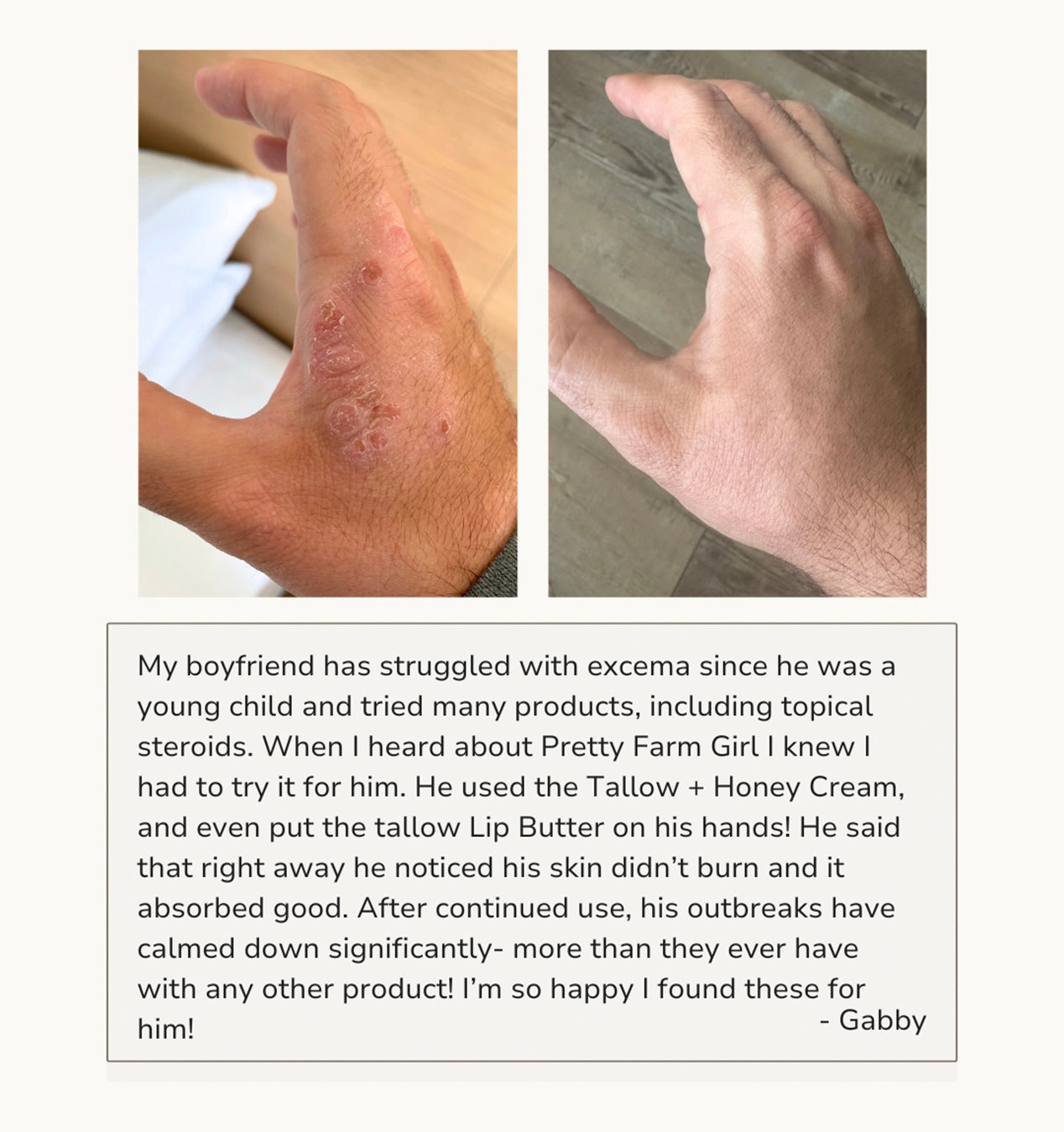 Gentle Tallow & Honey Cream for Delicate Skin