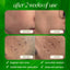 Limpiador exfoliante con microdermoabrasión de bambú