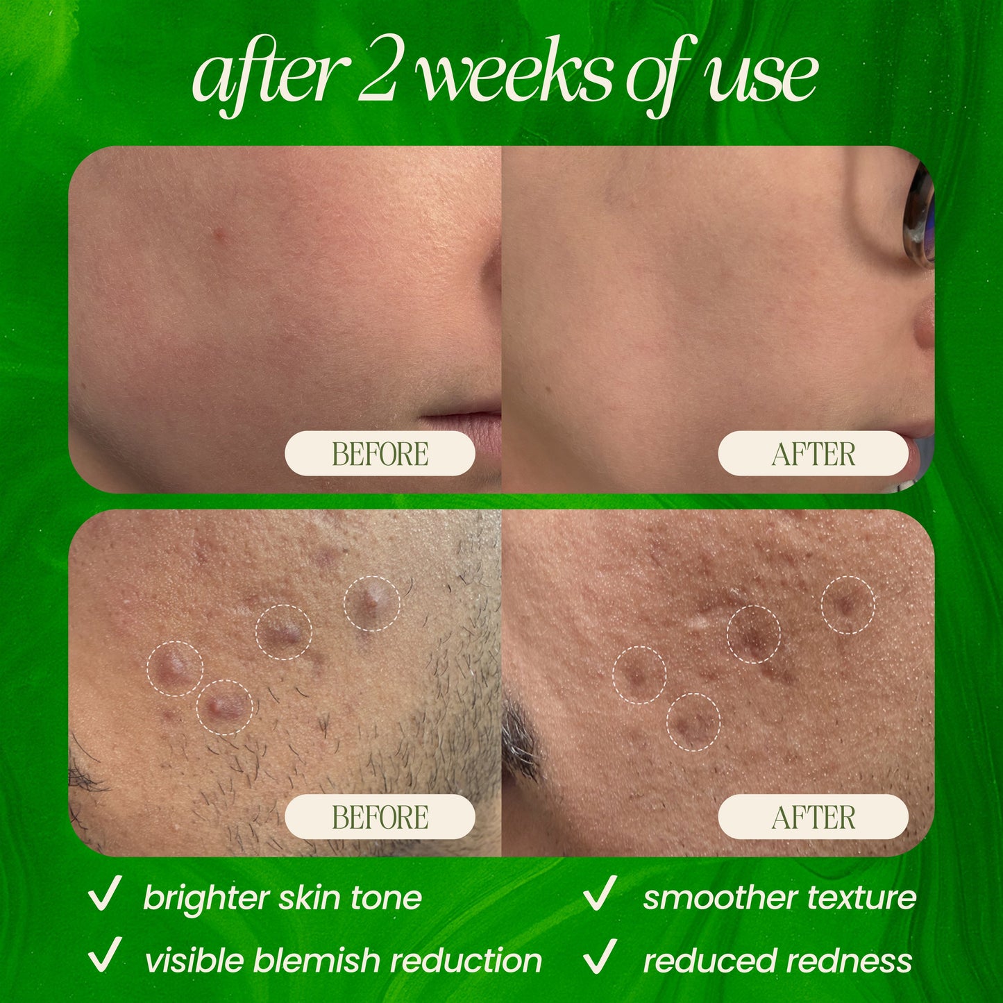 Limpiador exfoliante con microdermoabrasión de bambú